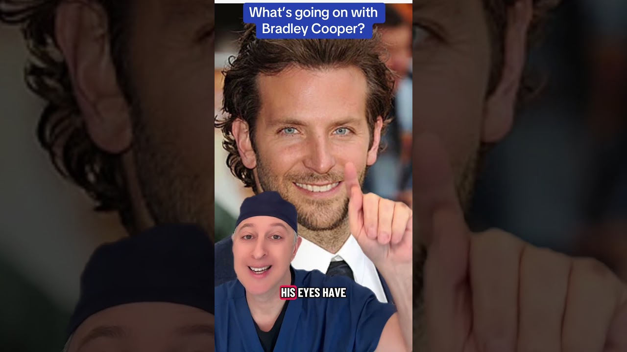 What’s up with Bradley Cooper? #facelift #blepharoplasty